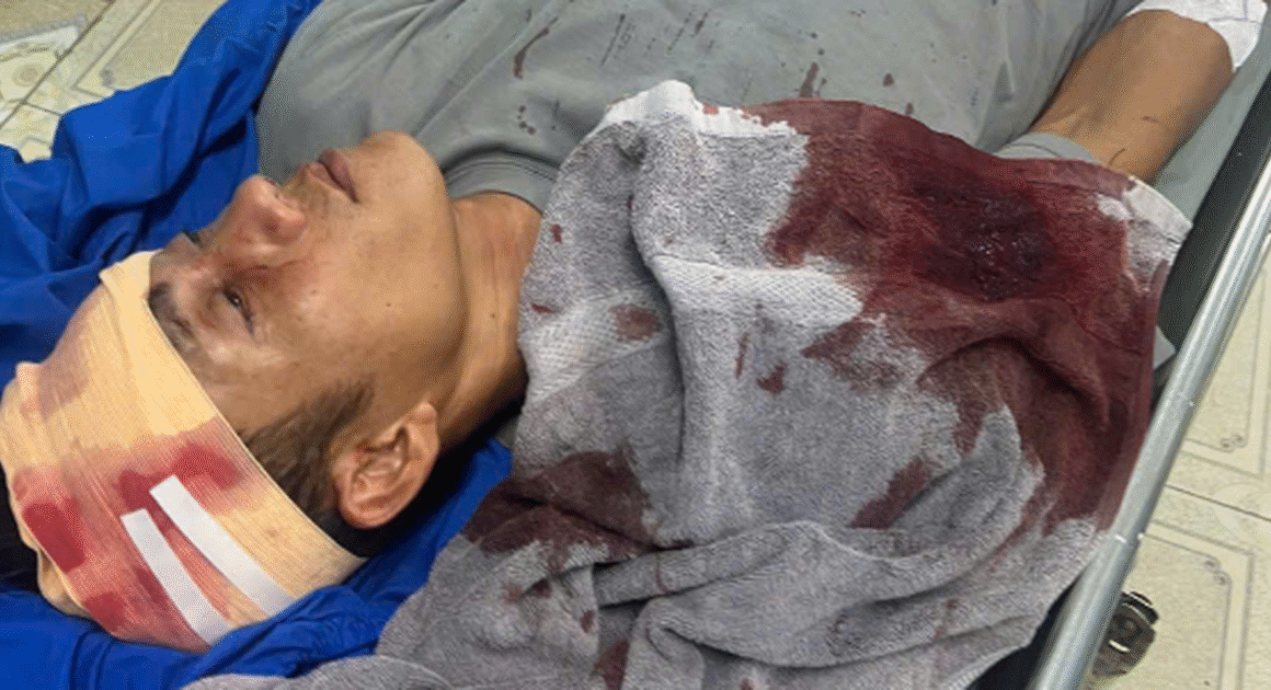 10 NGƯỜI XÔ VÀO QUÁN KARAOKE, CHÉM TRỌNG THƯƠNG CHỦ VÀ NHIỀU NGƯỜI – CHUYỆN GÌ ĐANG XẢY RA TẠI LÂM ĐỒNG?