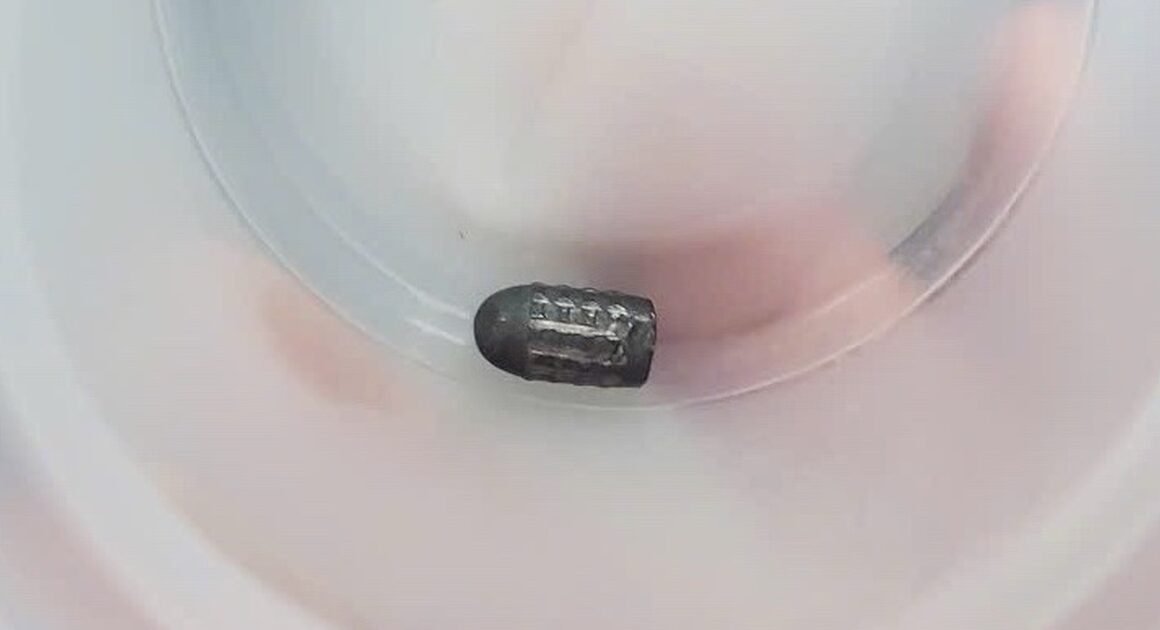 BÁO ĐỘNG CẬP NHẬT: NGƯỜI PHỤ NỮ 40 TUỔI Ở CẦN THƠ BẤT NGỜ VƯỢT ẦU ĐẶC BIÊT, VIÊN ĐẠN CHỈ XUYÊN QUA DA, CHẠM GẦN XƯƠNG CHẨM!