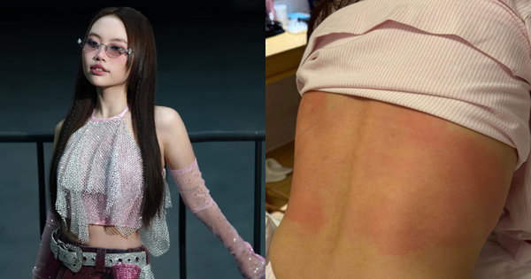 TÌNH HÌNH ĐÁNG BÁO ĐỘNG CỦA PHƯƠNG MỸ CHI KHIẾN FAN LO LẮNG KHÔNG NGỪNG