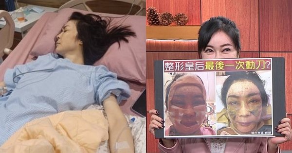 BẢN NÉN NÓNG: NGƯỜI ĐẸP CẨN TRỌNG HƠN AI, NHƯNG LẠI MẮC KẸT TRONG NGHIỆN DAO KÉO, ĐỂ MẠNG CẦU CẢNH GIÁC!