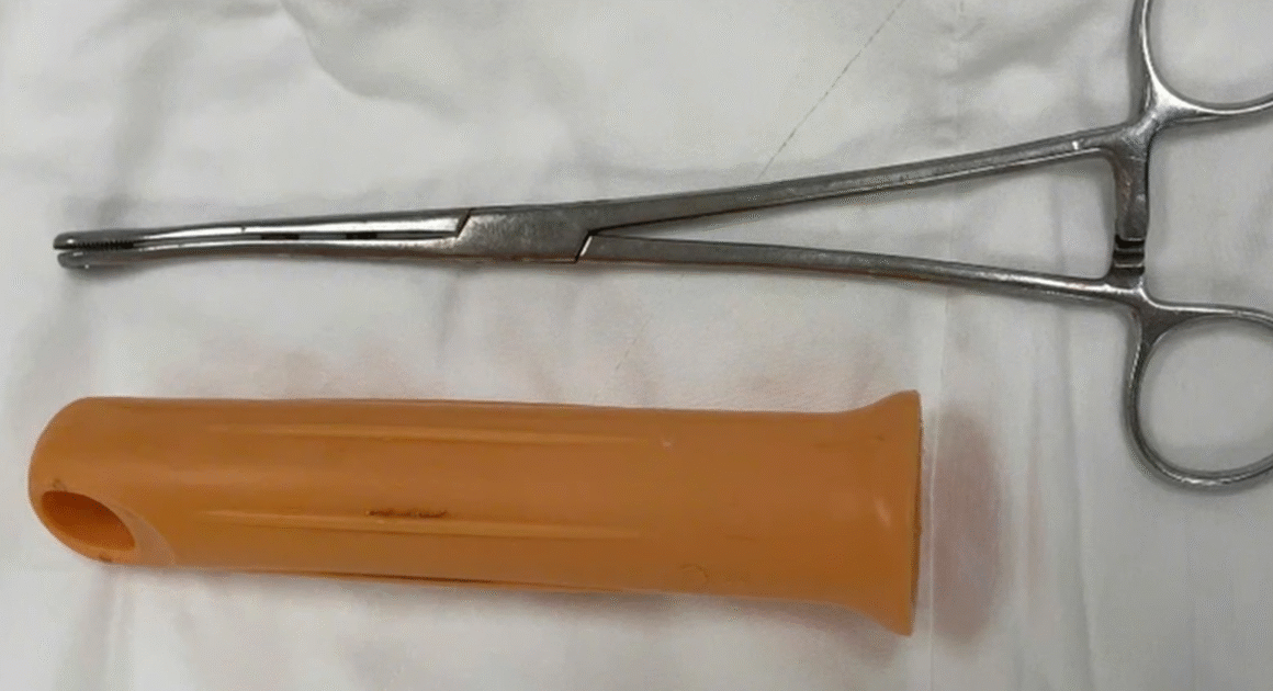 BỆNH NHÂN 23 TUỔI TỰ NHÈN CÂN CẦU LAU NHÀ VÀO HẬU MÔN, BÁC SĨ PHẢI MỔ CẤP, BẤT NGỜ VỚI HÀNH ĐỘNG ĐIÊN RỒ.