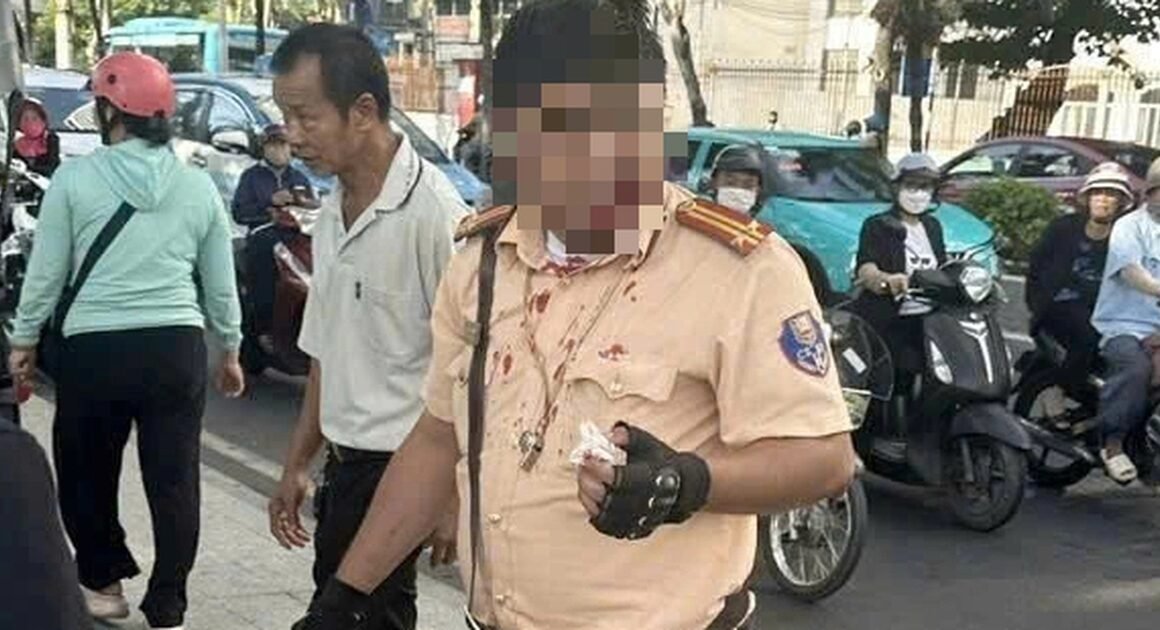 KHI CẢNH SÁT GIAO THÔNG ĐANG LÀM NHIỆM VỤ, MỘT NGƯỜI ĐÀN ÔNG NGA BẤT NGỜ TẤN CÔNG!