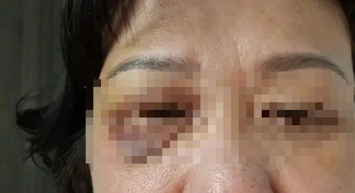 NGƯỜI PHỤ NỮ 60 TUỔI BỊ HÀNG XÓM TẤN CÔNG DÃ MAN GIỮA CHỢN CHƠI NƠI SẢNH CƯ DÂN!