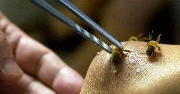 BÀ MẸ CAN TRƯƠNG HI SINH CỨU CON, GÂY CẢNH BÁO VỀ NGHỊCH CẢNH ĐỐI MẬT VỚI CÁC ĐÀN ONG VÒ VẺ