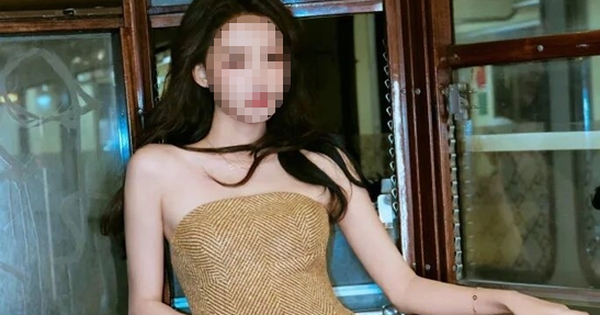 TẠI SAO TÔN DI BỊ SƯNG MẶT PHẢI NGƯỜI NGHĨ ĐÓ LÀ VẤN ĐỀ VỀ NHUỘM TÓC?