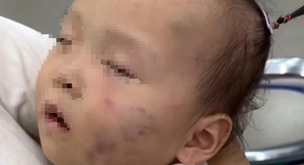 CON DAU Ở BẮC NINH ĐỔI TẤN VỚI BÉ GÁI HƠN 1 TUỔI: BẢO MẪU BỊ TẠM GIỮ VÌ HÀNH VI CỐ Ý GÂY THƯƠNG TÍCH