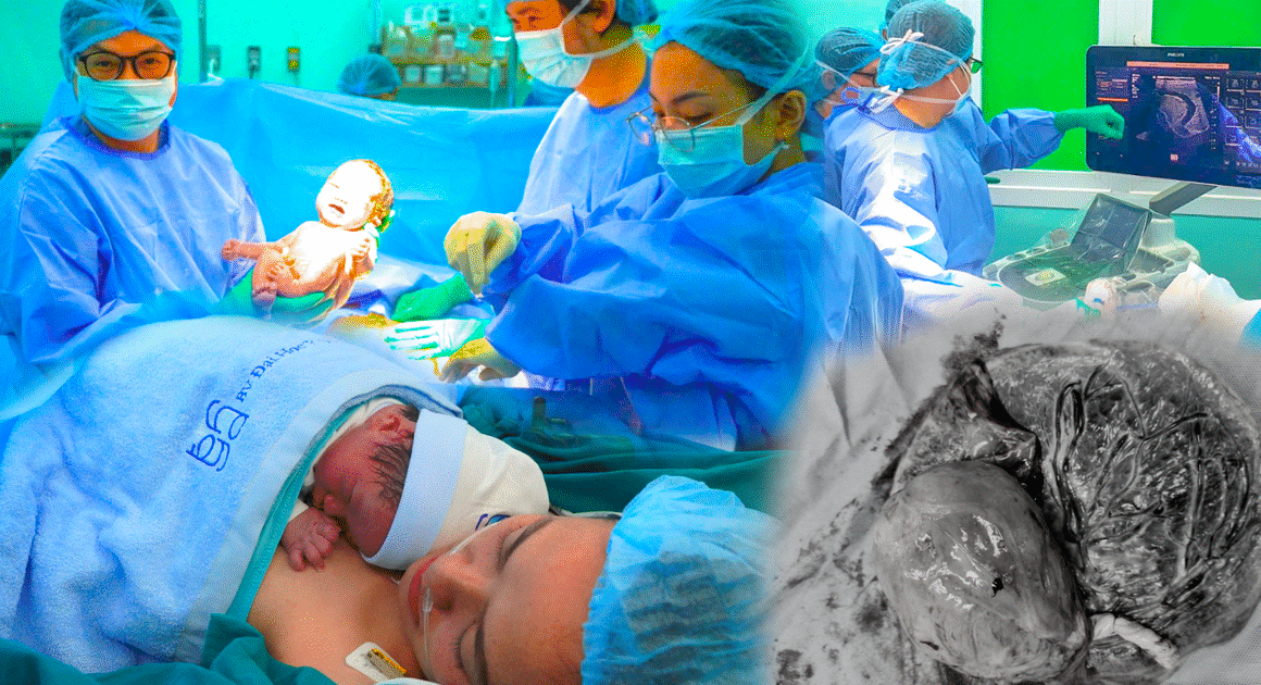 BÁC SĨ TẠI TP.HCM ĐÃ CỨU SỐNG THAI NHI TRONG BỤNG MẸ NHỜ THỦ THUẬT CAN THIỆP BÀO THAI ĐẦU TIÊN TRÊN ĐẠI CHỈ.