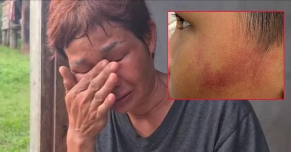 KINH HOÀNG: BÉ 7 TUỔI BỊ CÔ GIÁO ĐÁNH NỮA VÀ BẮT RỬA NHÀ VỆ SINH CHỈ VÌ LẤY KẸO MÖRSHmallow!