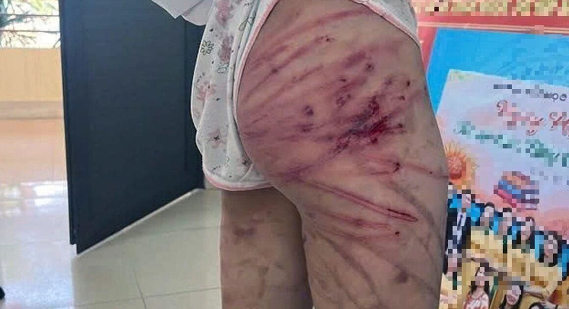 BÉ GÁI 11 TUỔI Ở HÀ TĨNH NHẬN GẠO NHANH CHỈ VÌ BỊ CHA DƯỢNG BẠO HÀNH?