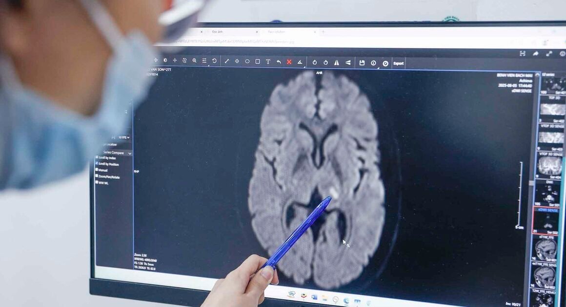 CHƯA ĐẦU HỘI NGHỊ CUỐI TUẦN, ĐẾN 4 CA ĐỘT QUỴ XUẤT HUYẾT NÃO CẦN CẤP CỨU TẠI XANH PÔN!