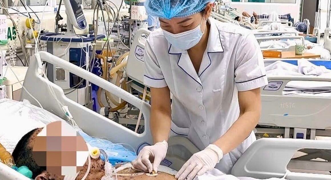 CHỈ SAU 4 NGÀY TỰ CHỮA, BỆNH NHÂN THỦY ĐẬU GẶP NGUY CƠ TỬ VONG VÌ CHUYỄN BIẾN NGHIỆM TRỌNG!