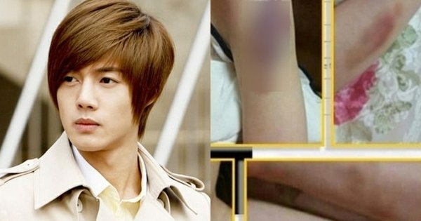 SỰ THẬT ĐEN TỐI CHƯA TỪNG BỊ KHAI MINH CỦA KIM HYUN JOONG BỘC LỘ GẦN ĐÂY, GÂY CHẤN ĐỘNG XÃ HỘI