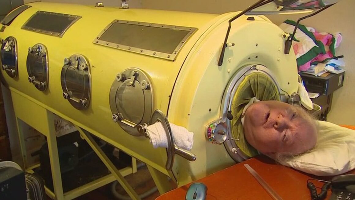 BẤT NGỜ, NGƯỜI ĐÀN ÔNG SỐNG TRONG MỘT CỐT SẮT – KHÁM PHÁ BÊN TRONG ĐỂ BIẾT GÌ?