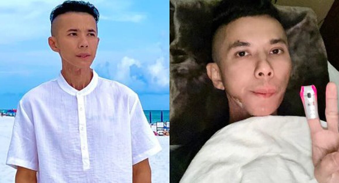 BÙNG NỔ KHÔNG NGỜ, SAO CA SỐNG CHỦNG U XƯƠNG HÀM TRONG ĐÓNG CỬA VÀNG KHÓ KHĂN