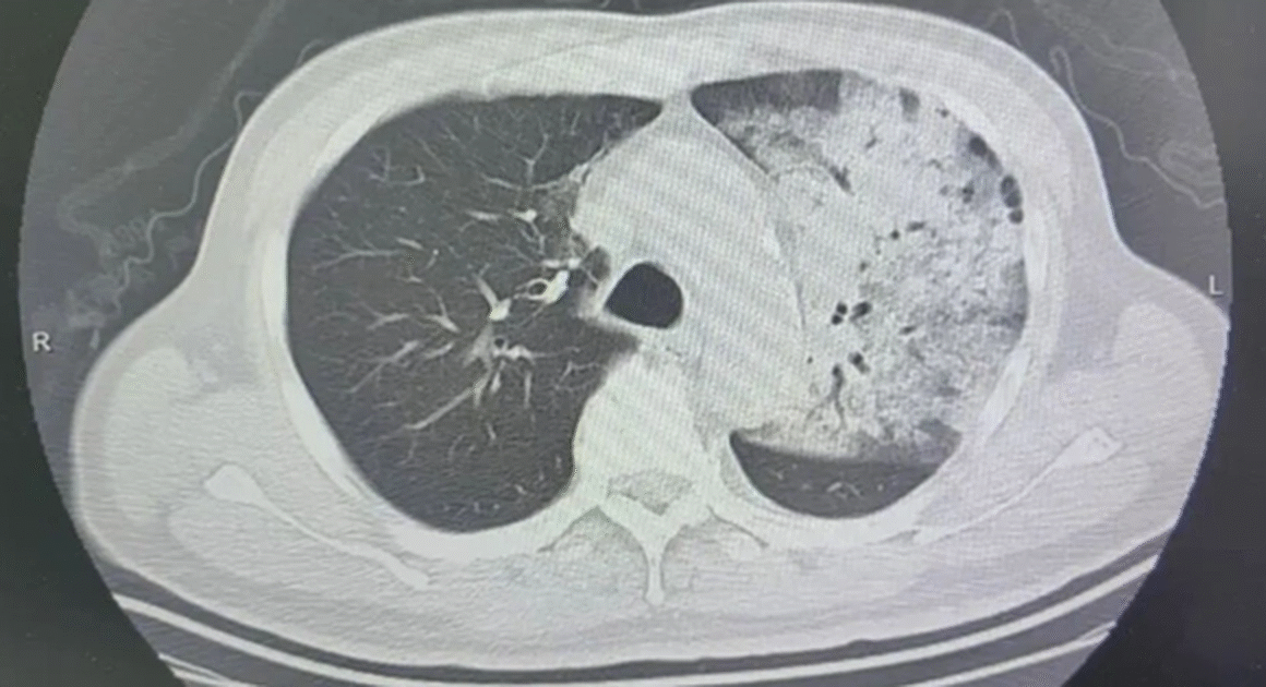 BỀN BỈ VỚI CHIẾC ĐIỀU HÒA CŨNG CÓ THỂ GẬY NGƯỜI NHIỀU NGƯỜI KHÔNG NGỜ ĐẾN RỦI RO SỨC KHỎE NGHIÊM TRỌNG!