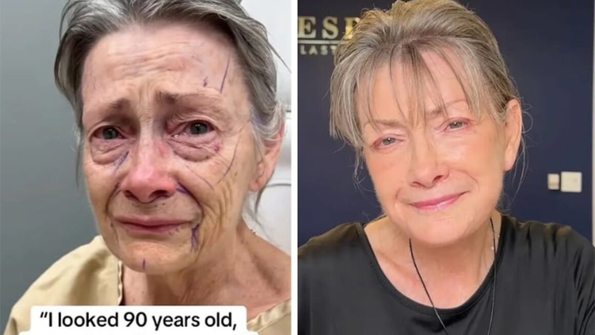 KHÁM PHÁ PHƯƠNG PHÁP CĂNG DA MẶT SIÊU ĐỘT PHÁ GIÚP NỮ BỆNH NHỎ LẠI HÀNG CHỤC NĂM MỘT CÁCH TỰ NHIÊN