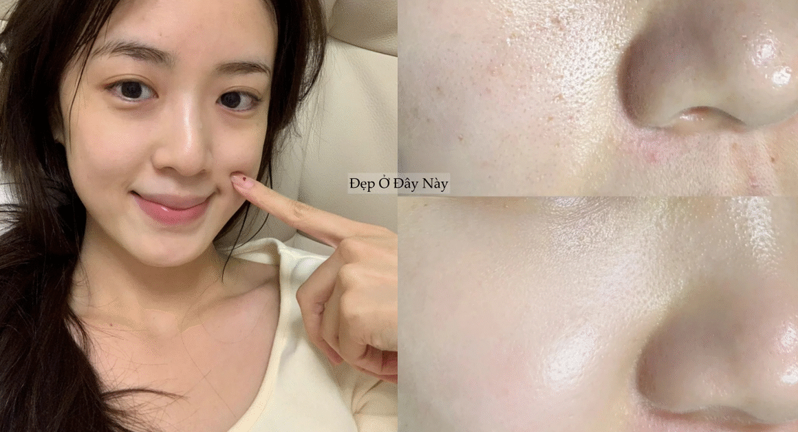 BẠN ĐÃ BIẾT CHƯA, BẮT ĐẦU SỚM VỚI SẢN PHẨM PHÙ HỢP LÀ CHIẾN THẮNG_CHO LÀN DA KHỎE ĐẸP THEO THỜI GIAN?