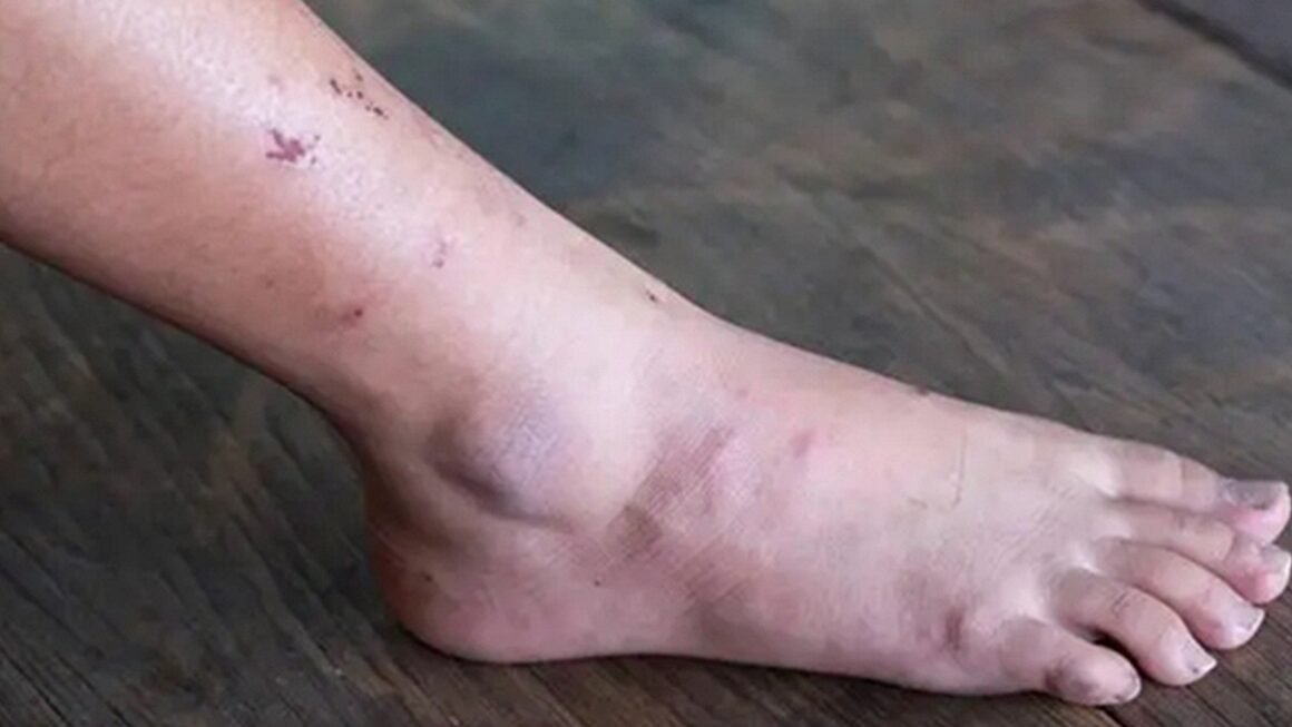 BẠN ĐÃ BIẾT CHƯA: UNG THƯ MỚI BẮT ĐẦU THÀNH HÌNH, DÙ AI CŨNG CÓ THỂ BỎ LƠ?