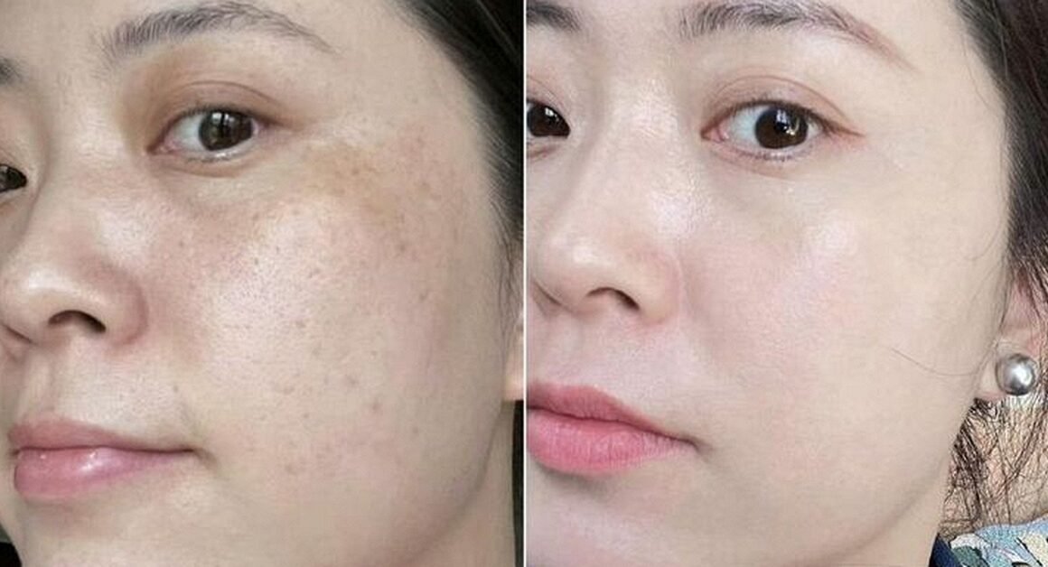 BẠN CÓ BIẾT NHỮNG THÓI QUEN ĐƠN GIẢN TRƯỚC KHI ĐI NGỦ CÓ THỂ “LÀM MỚI” LÀN DA CỦA BẠN NHƯ THẾ NÀO?