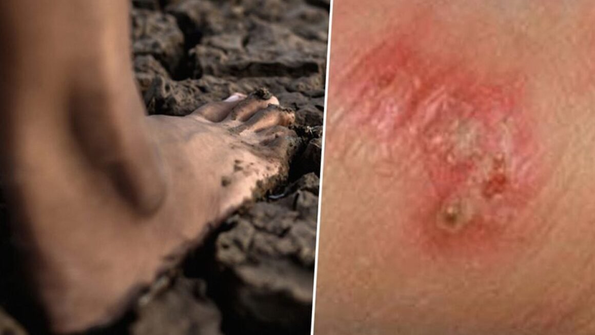 KHÔNG PHẢI AI CŨNG NHẬN BIẾT ĐƯỢC, BIỂU HIỆN BỆNH CÓ THỂ GIỐNG CẢ CẢM LẠNH VÀ CÚM THÔNG THƯỜNG!