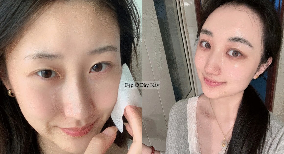 KHÁM PHÁ 5 BƯỚC ĐƠN GIẢN GIÚP CỨU NGUY LÀN DA TỐI ĐA CHỈ TRONG VỐN VÀI PHÚT!