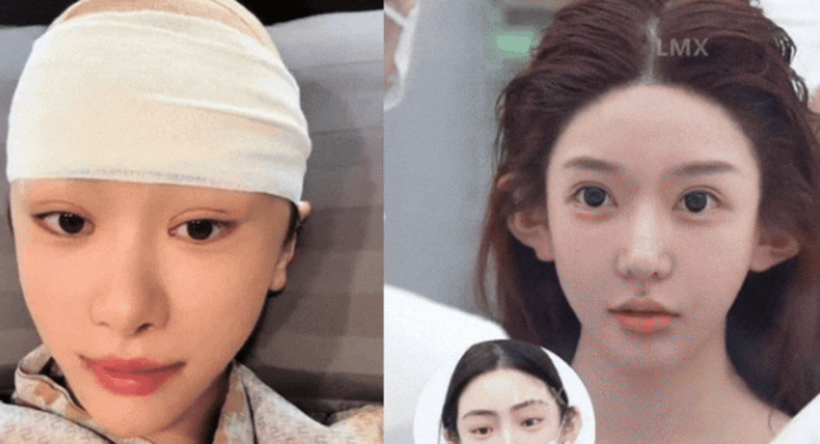 CƠN SỐT MẶT V-LINE VÀ TAI YÊU TINH ĐANG GÂY CHÁO ĐÁO, NHƯỢC ĐIỂM KHÔNG NGỜ ĐẾN TỪ GIỚI TRẺ TRUNG QUỐC