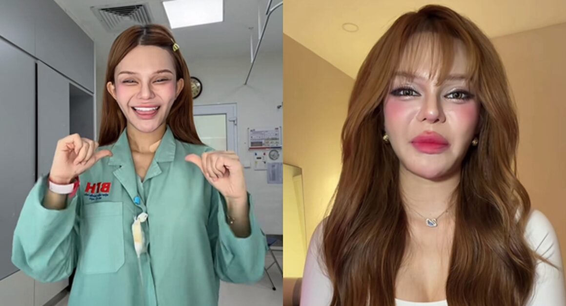 BẠN SẼ KHIẾN NGƯỜI KHÁC NGẠC NHIÊN VỚI CÂU CHUYỆN PHẪU THUẬT THẨM MỸ CỦA NỮ TIKTOKER TRÊN 11 TRIỆU FOLLOWER!