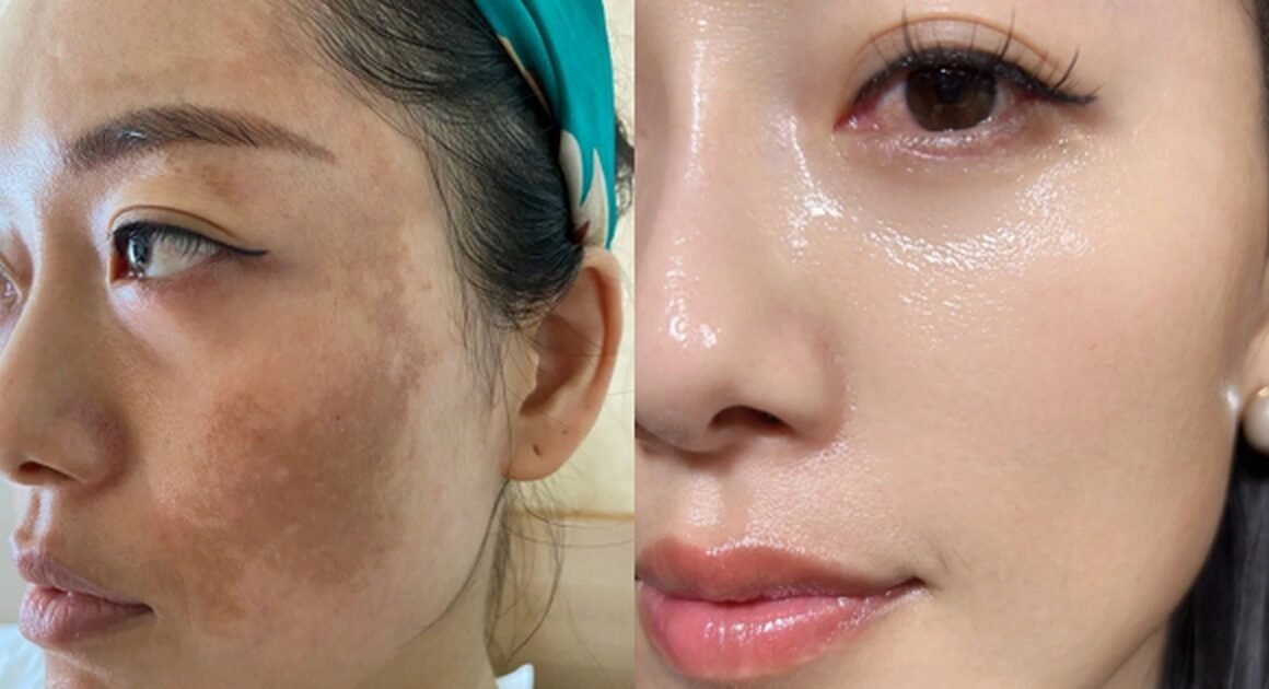 KHÁM PHÁ PHƯƠNG PHÁP DƯỠNG DA ĐƠN GIẢN MÀ HIỆU QUẢ CHỈ VỀ ĐÊM!