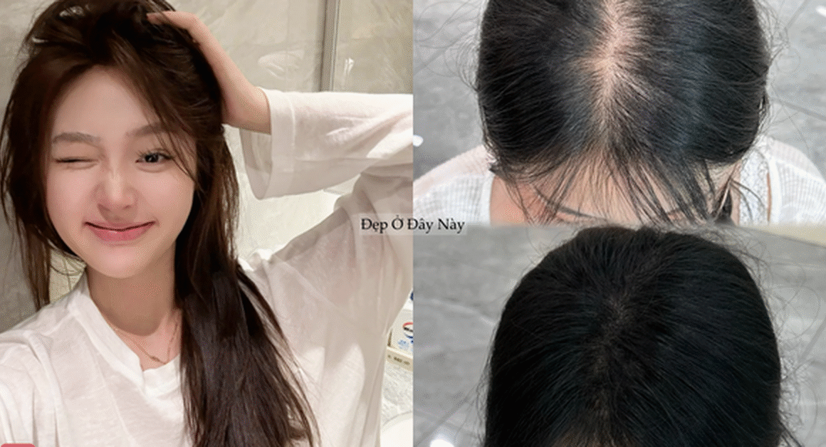KHÁM PHÁ TOP 5 DÒNG DẦU GỘI “MADE IN VIETNAM” GIÚP KÍCH THÍCH TÓC DẦY MỊN, KHỎE MẠNH!