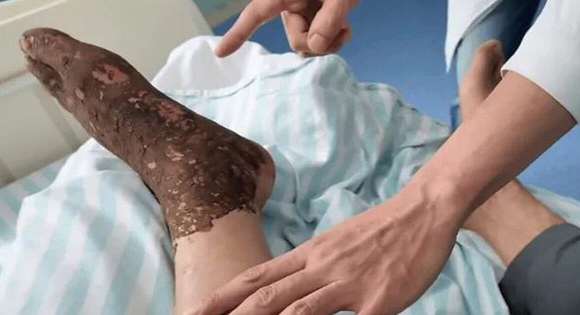 KINH NGẠC! CHỈ VỚI CÁCH XỬ LÝ ĐÚNG, NGƯỜI ĐÀN ÔNG TRÁNH ĐƯỢC HOẠI TỬ CHI TỪ VẤT NẶN RẮN