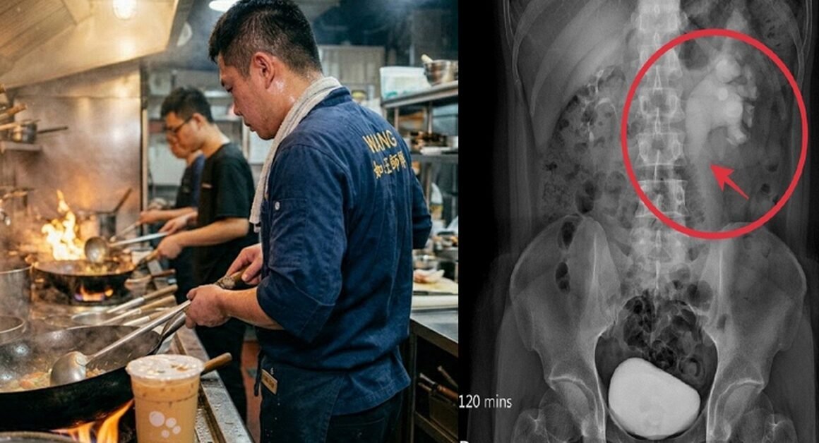ĐAU BỤNG DỮ DỘI NHƯ VẬT NHẢY, BỆNH NHÂN PHÁT HIỆN BỊ HỘI CHỨNG THẬN HƯ CẤP TÍNH VỎI TỪ MỘT THÓI QUEN ĐƠN GIẢN!