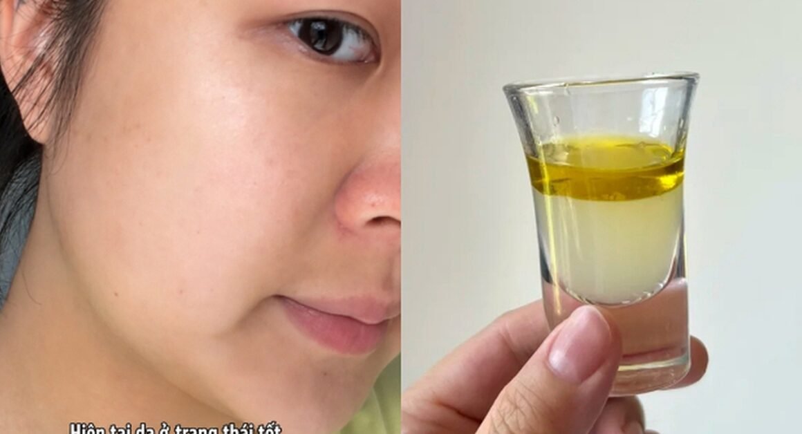 BẠN CÓ BIẾT: GẦN NHƯ MỌI VẤN ĐỀ DA ĐỀU BẮT ĐẦU TỪ BÊN TRONG CƠ THỂ?